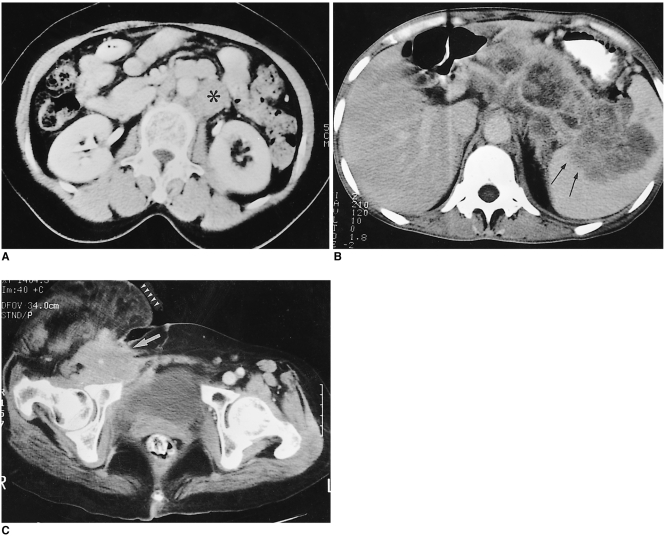 Fig. 10