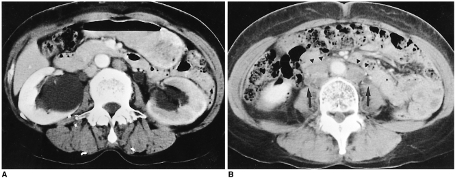 Fig. 18