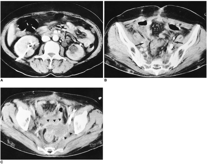 Fig. 17