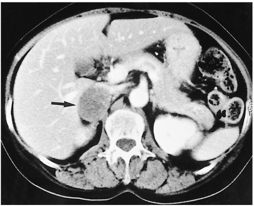 Fig. 14