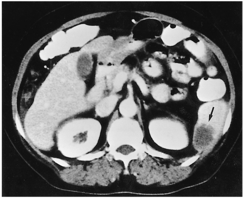 Fig. 15