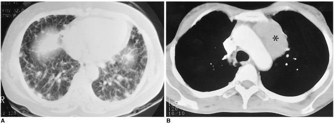 Fig. 11