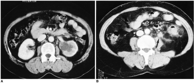 Fig. 19