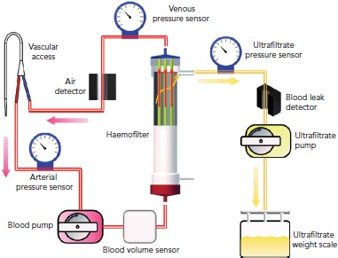 Figure 1A: