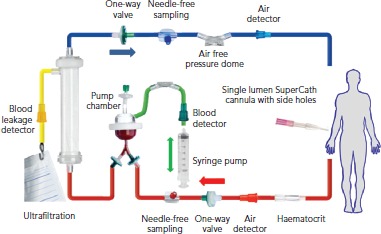 Figure 1B: