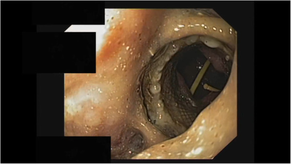 Fig. 3
