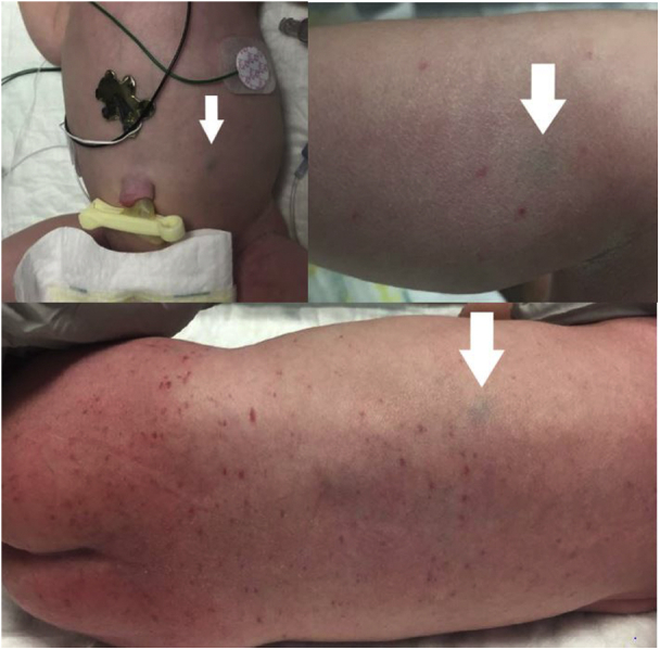 Fig 1
