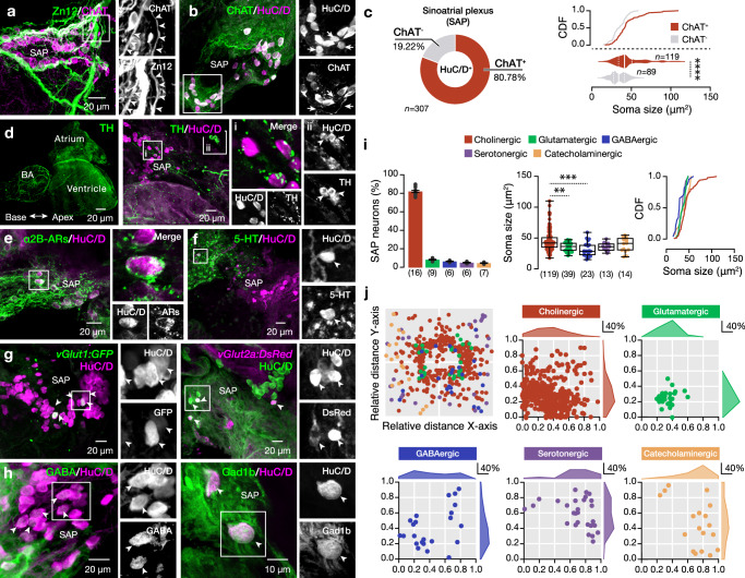 Decoding the molecular, cellular, and functional heterogeneity of ...