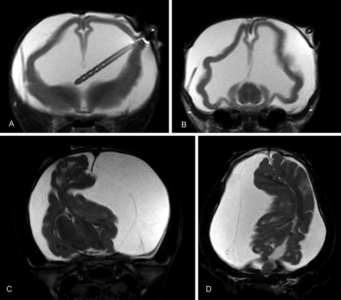 Fig. 14