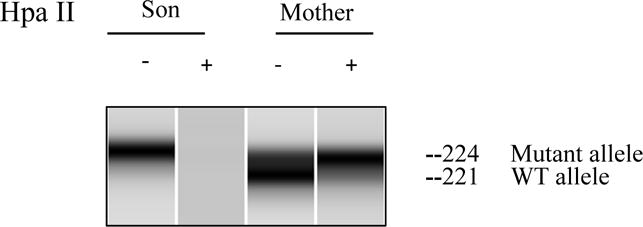 Figure 2E