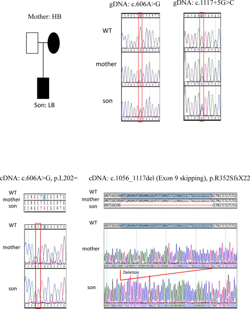 Figure 1E