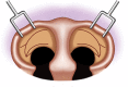 Fig. 3.