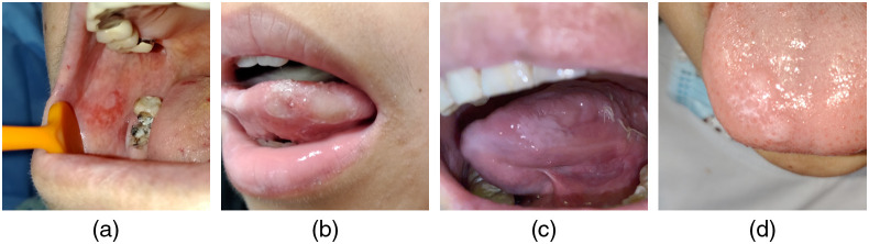 Fig. 10