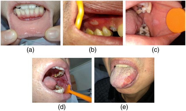 Fig. 3