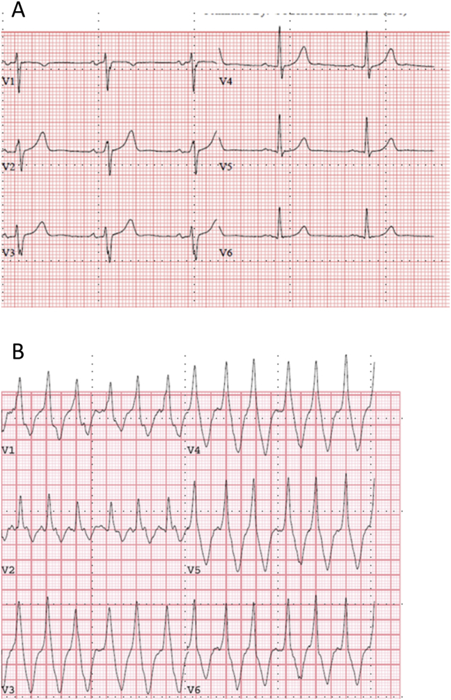 Fig. 1