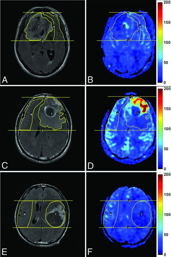 Fig 1.