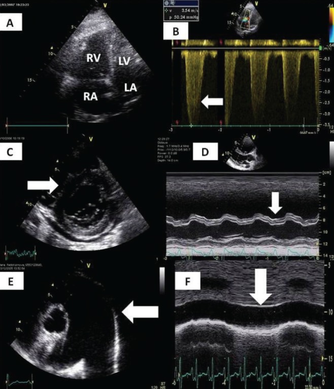 Figure 5)