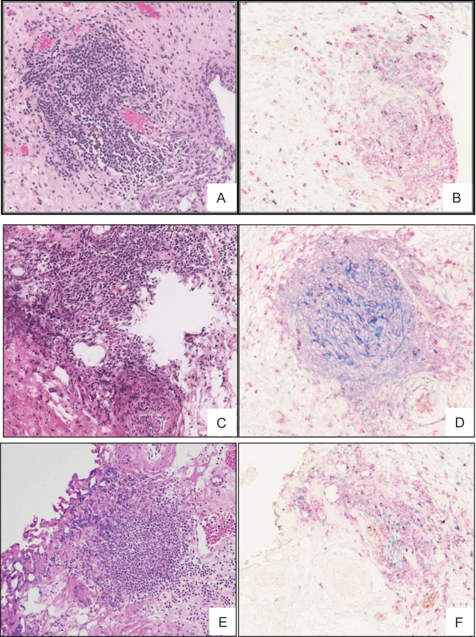 Fig.2