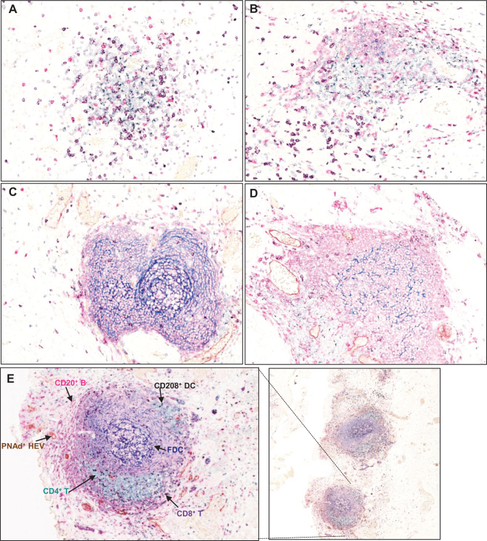 Fig.1