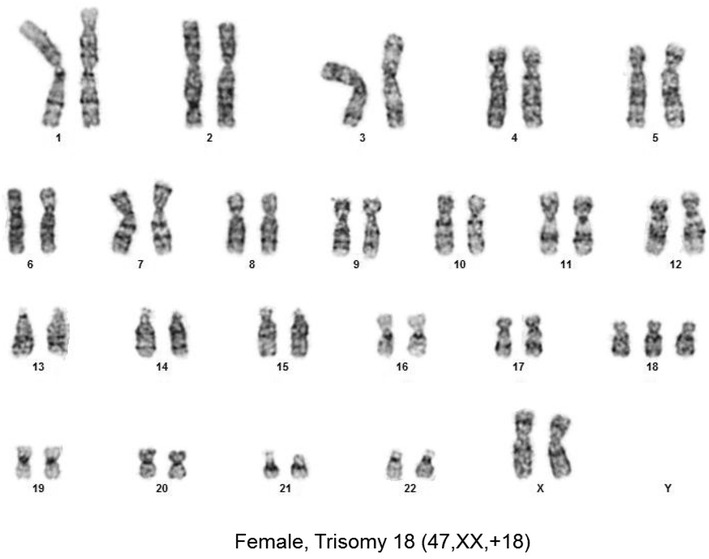 Fig. 1