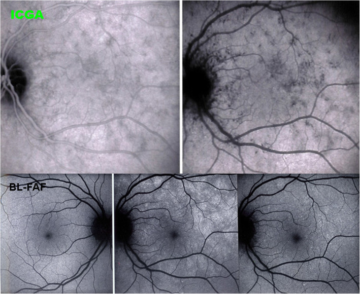 Fig. 14