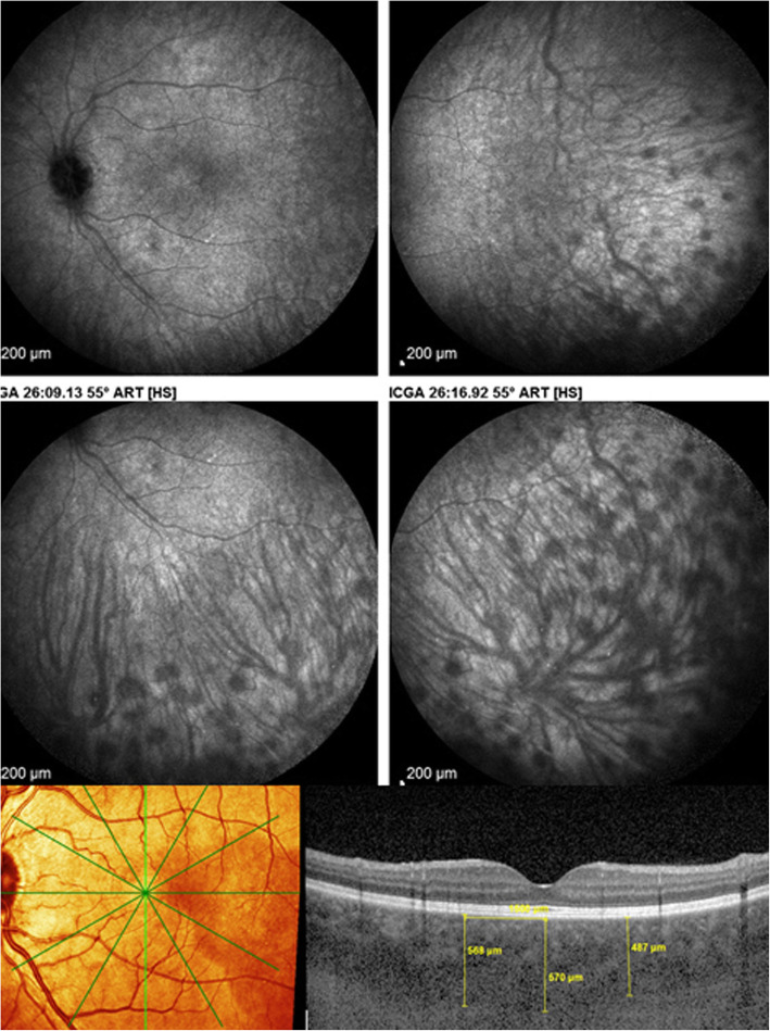 Fig. 12