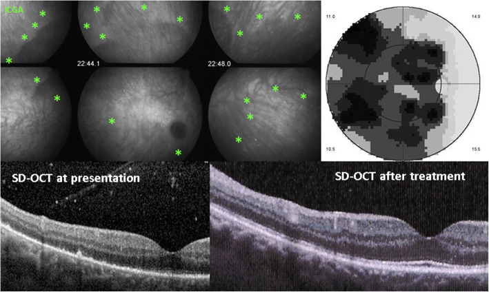 Fig. 11