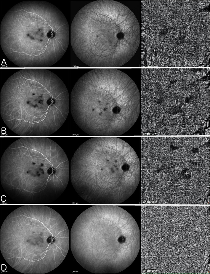 Fig. 13