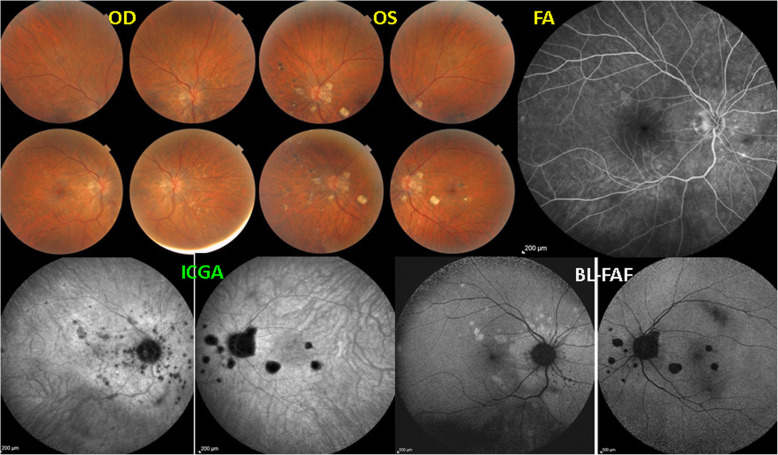 Fig. 17