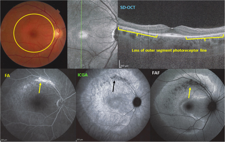 Fig. 16