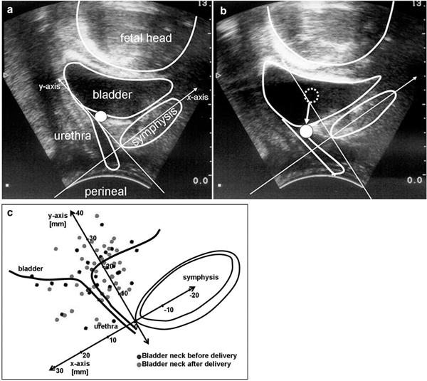 Figure 1a+b