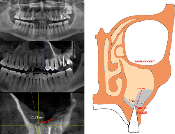 Fig. 3