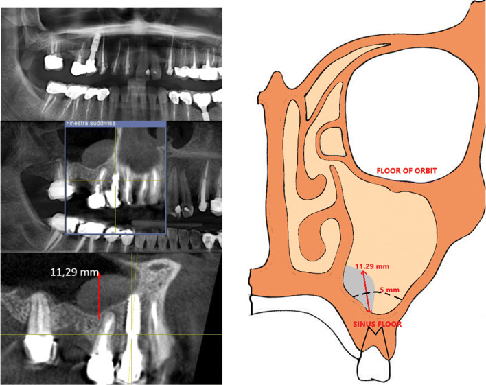 Fig. 5