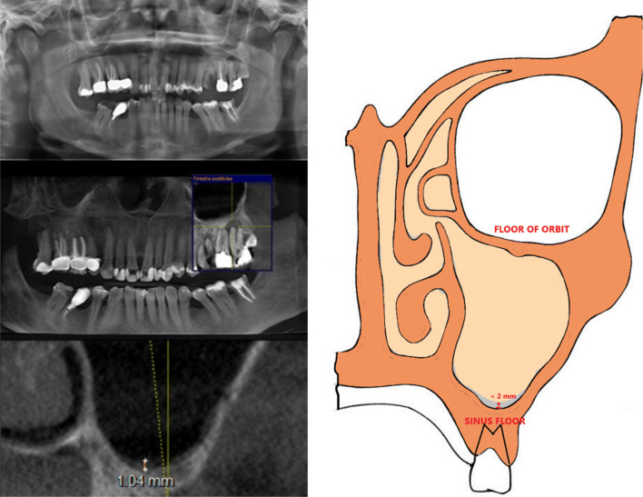 Fig. 1