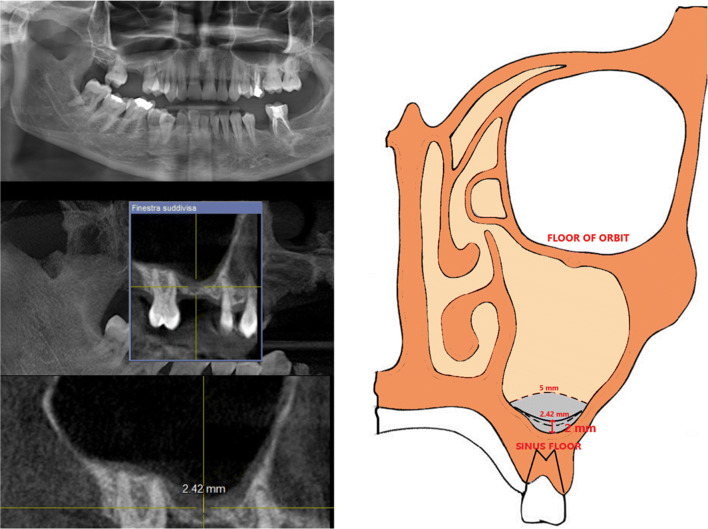 Fig. 2