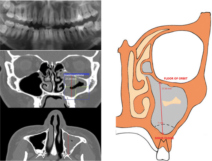 Fig. 4