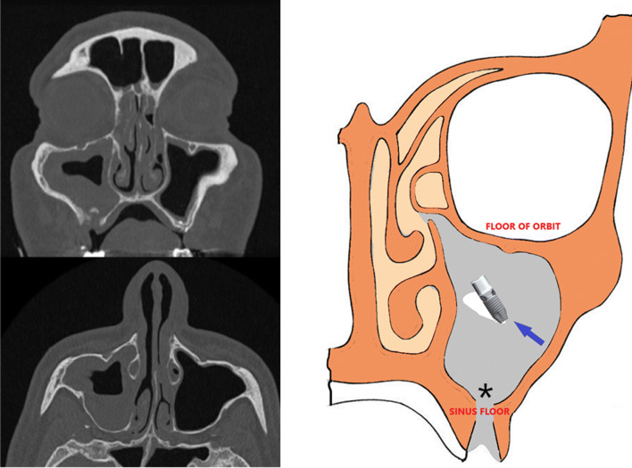 Fig. 6