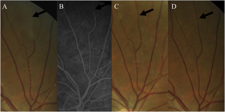 Fig. 4