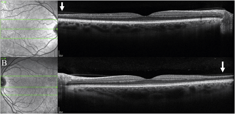 Fig. 5