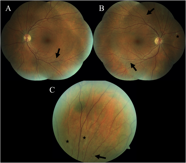 Fig. 2