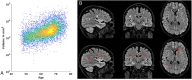 Fig. 18