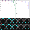 Fig. 14