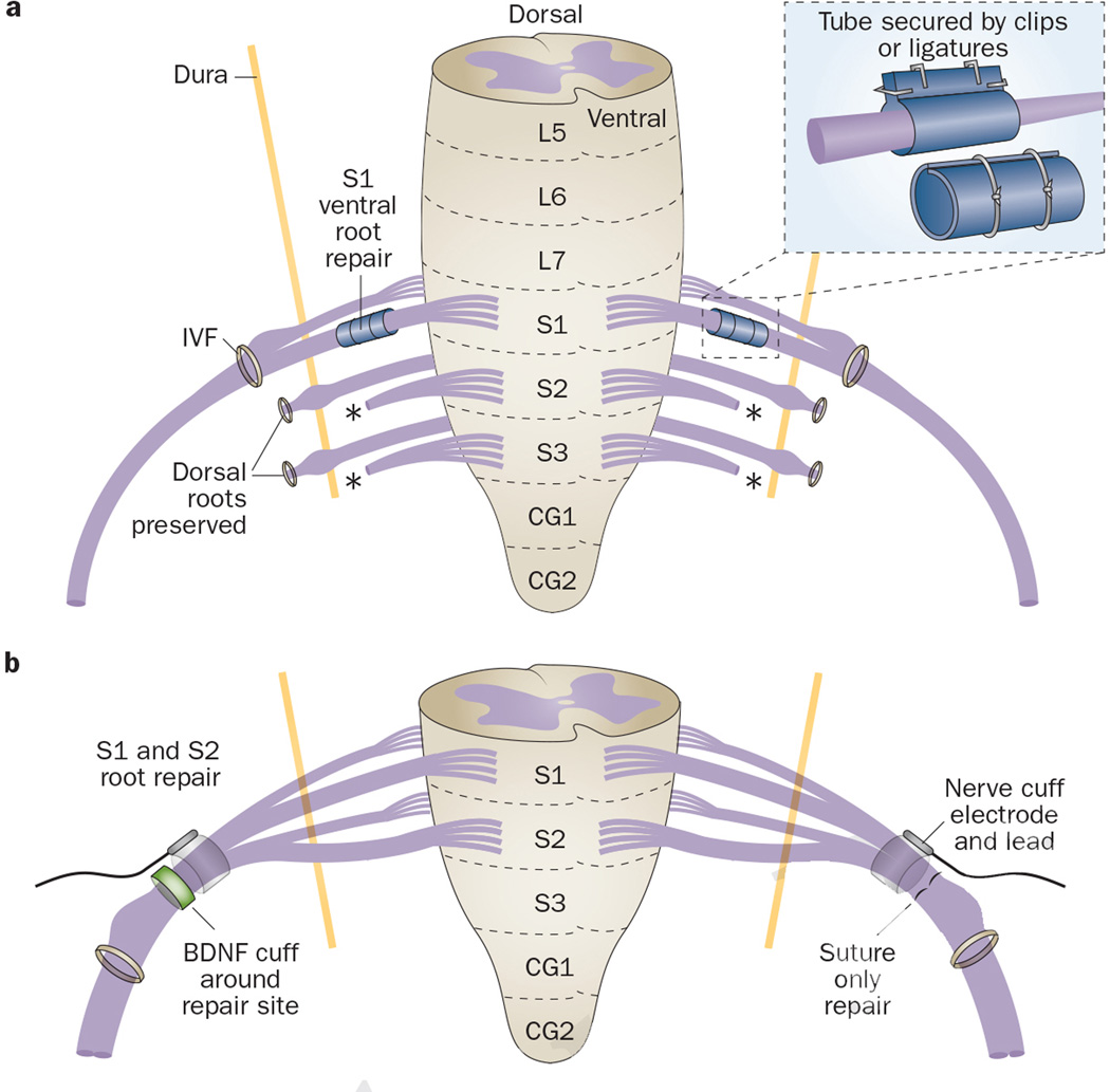 Neural reconstruction methods of restoring bladder function - PMC