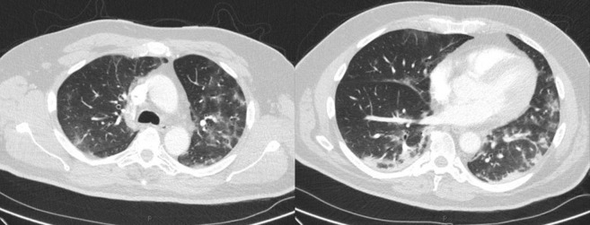 Fig. 2