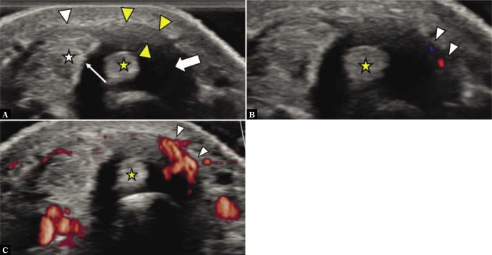 Fig. 9.