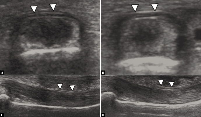 Fig. 20.