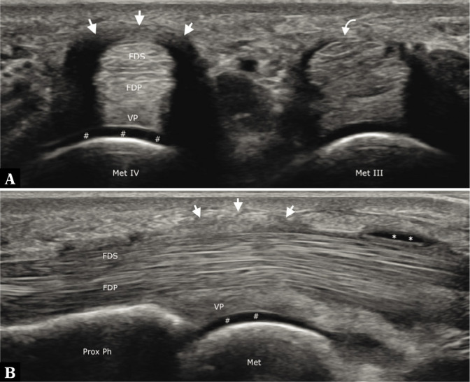 Fig. 18.