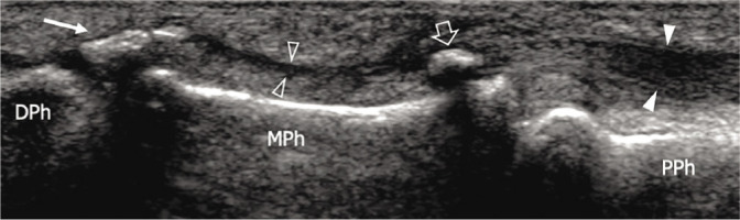 Fig. 17.