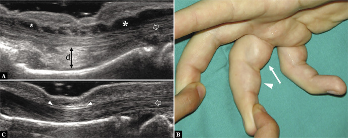 Fig. 21.