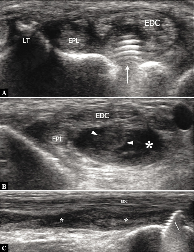 Fig. 12.